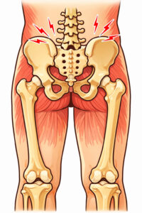 骨盤の上が痛いイラスト